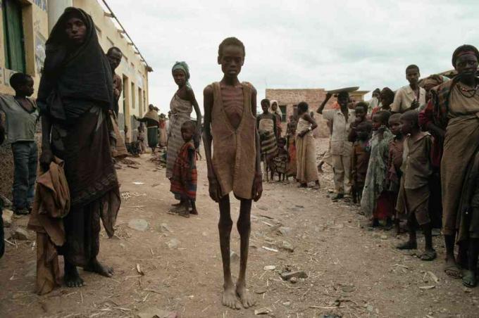 קורבנות הרעב כתוצאה ממלחמת האזרחים בסומליה.
